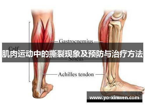 肌肉运动中的撕裂现象及预防与治疗方法 肌肉运动中的撕裂现象及预防与治疗方法